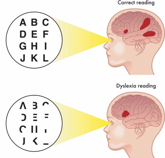 How a Weekly Dyslexia Assessment in Melbourne Project Can Change Your Life